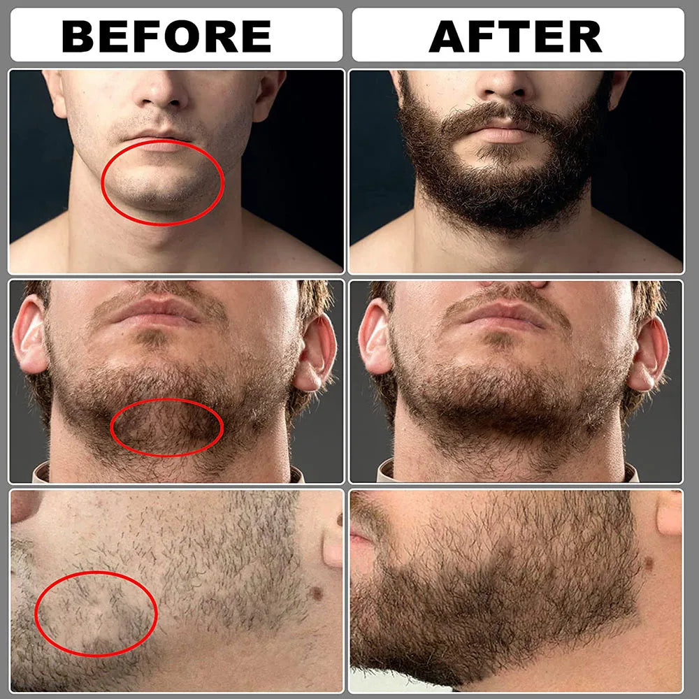 Beard Growth Kit